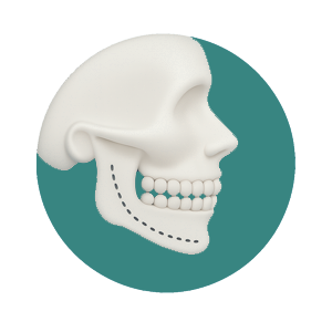 Illustration of a scull with surgery line